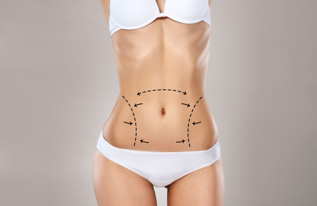 Abdominoplastie Tunisie prix